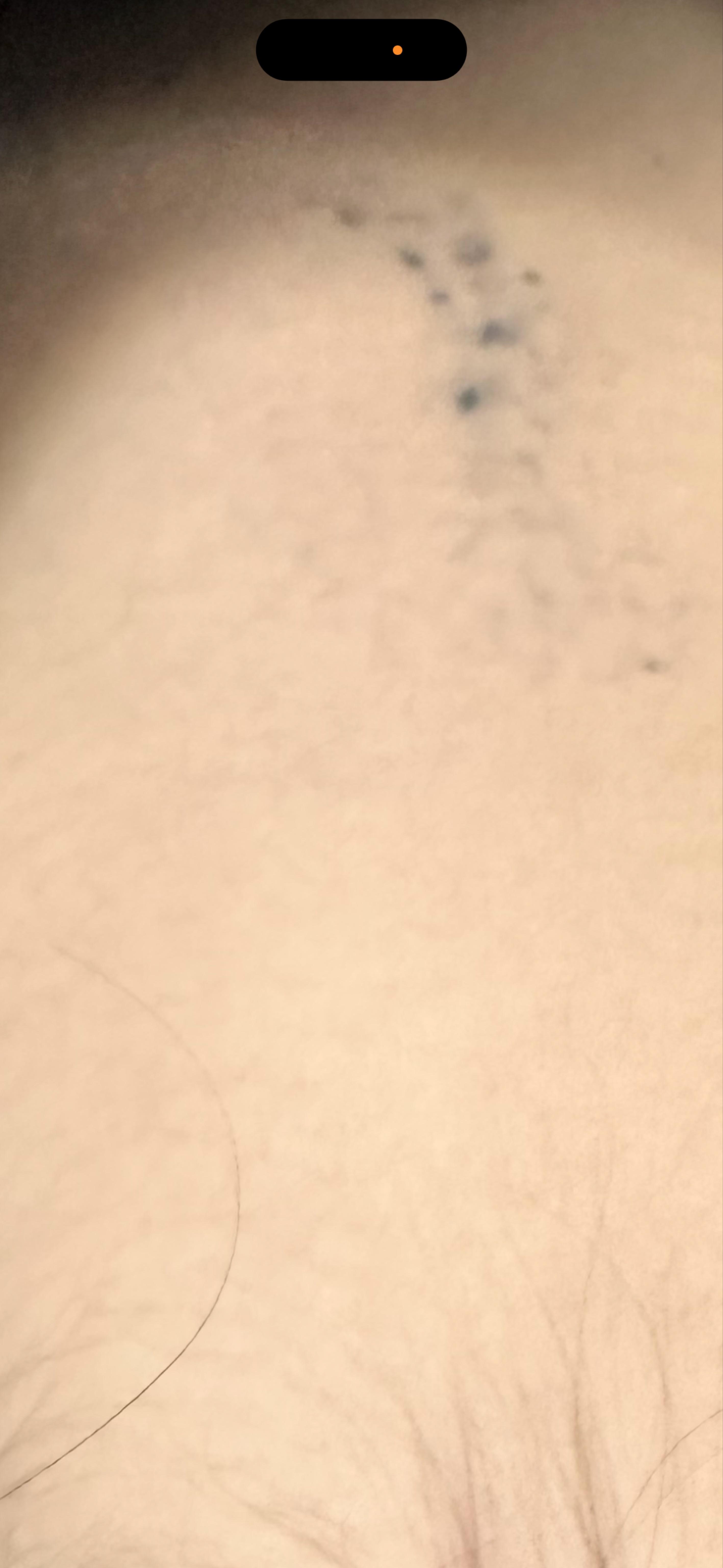 後