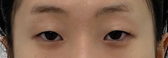 後