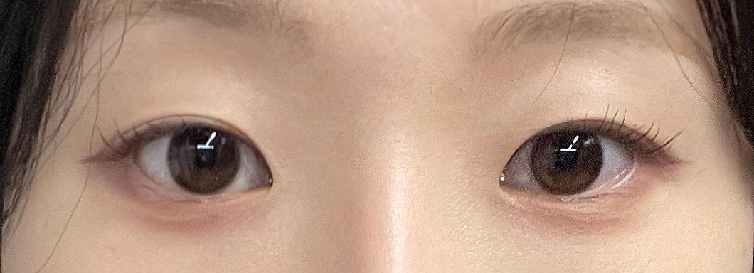 後