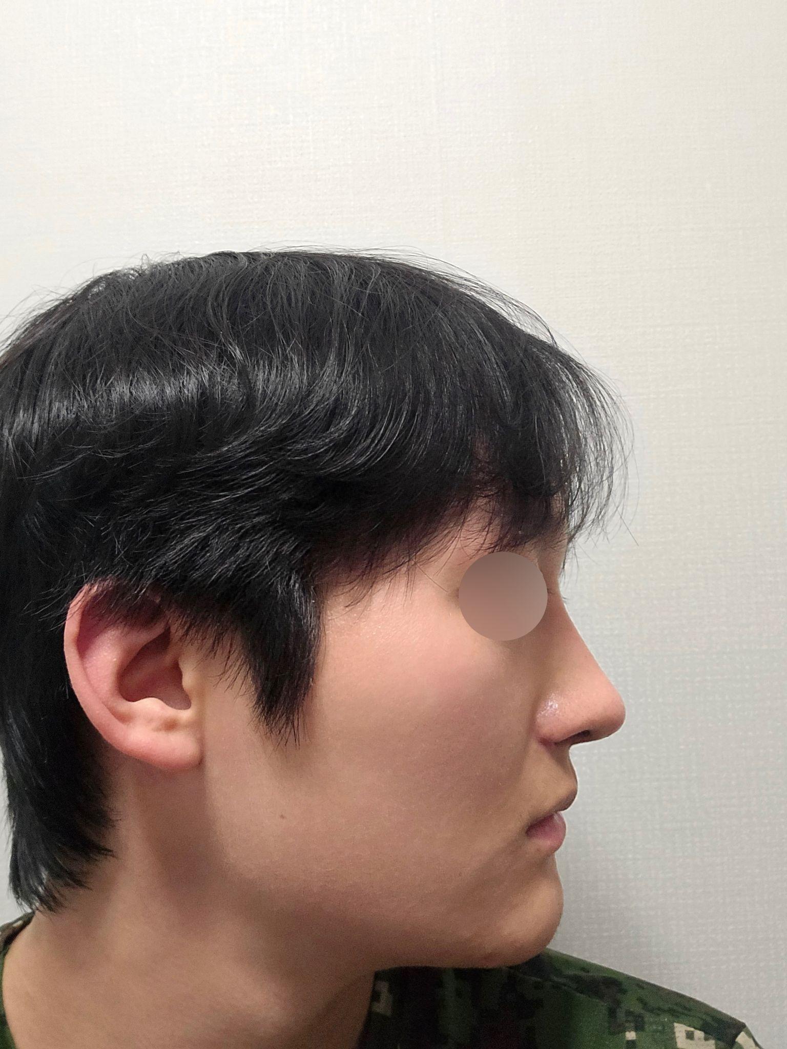 後