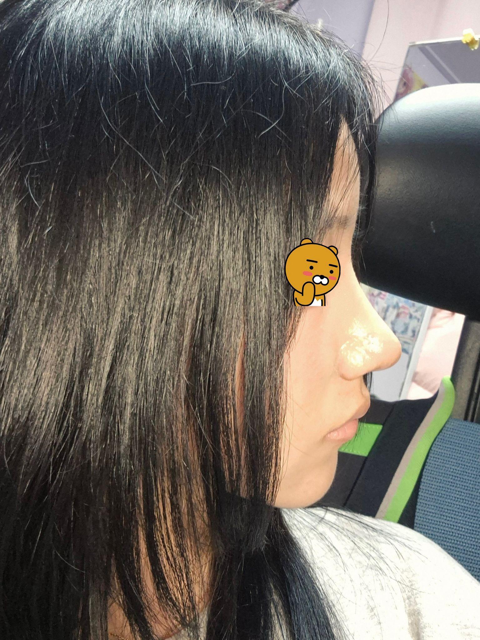 後