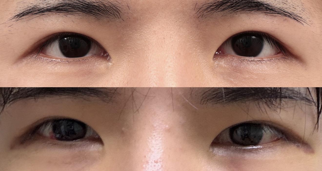 後