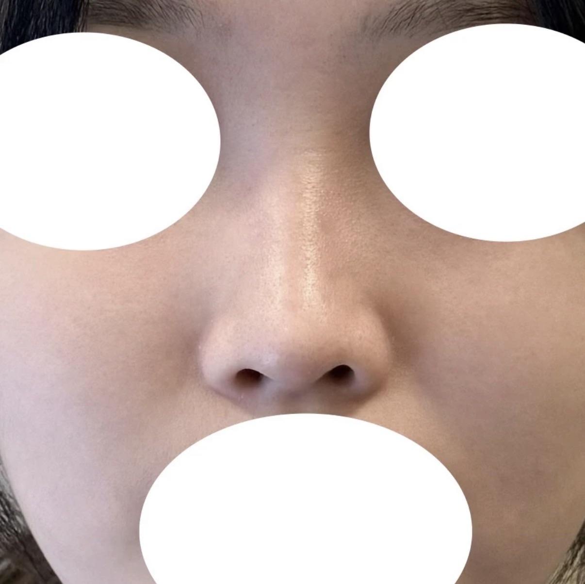 後