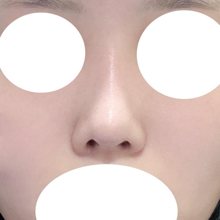 後