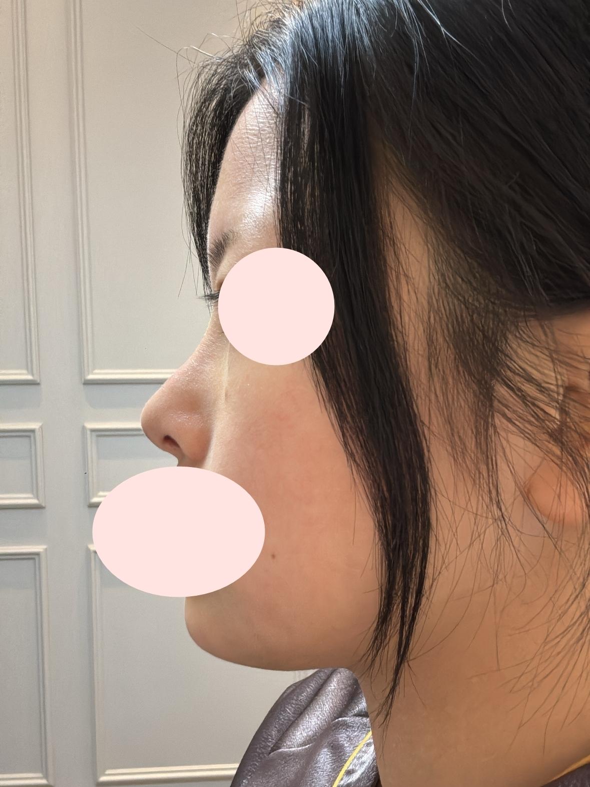 後