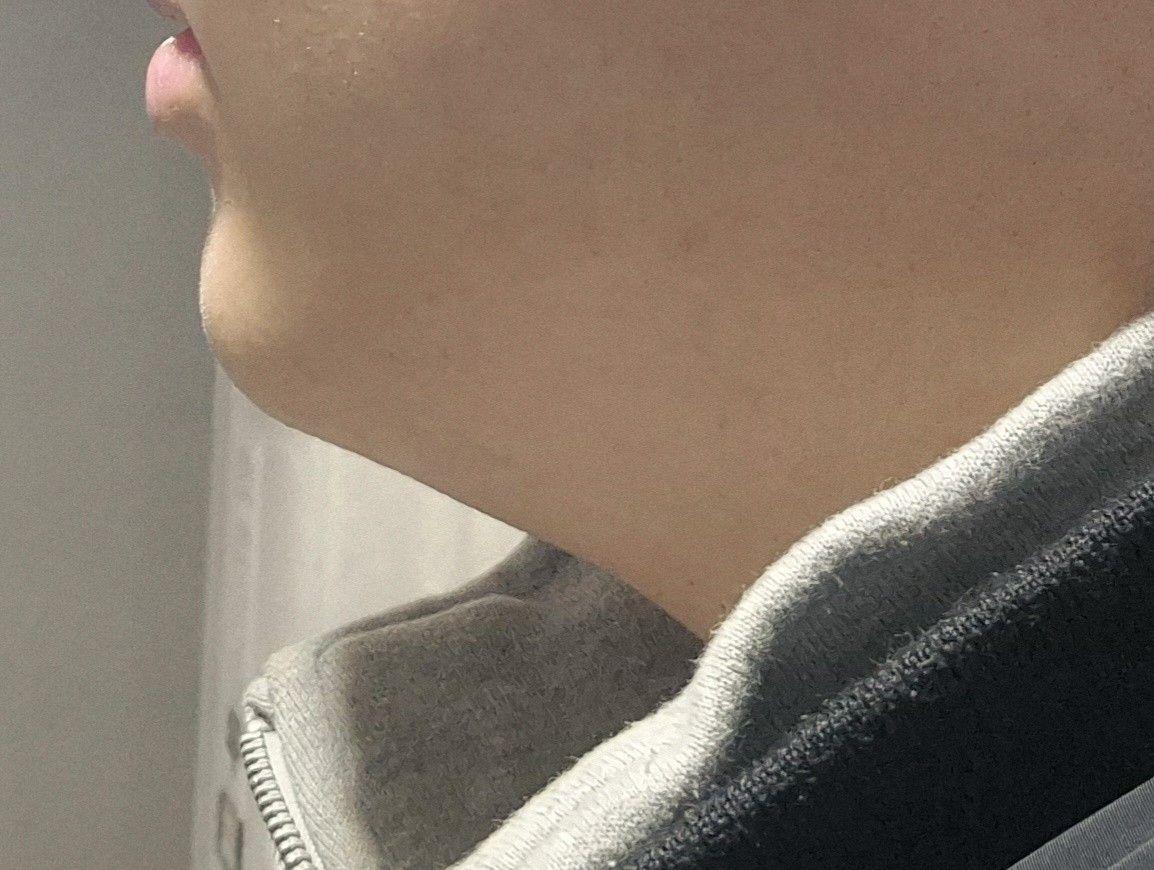後