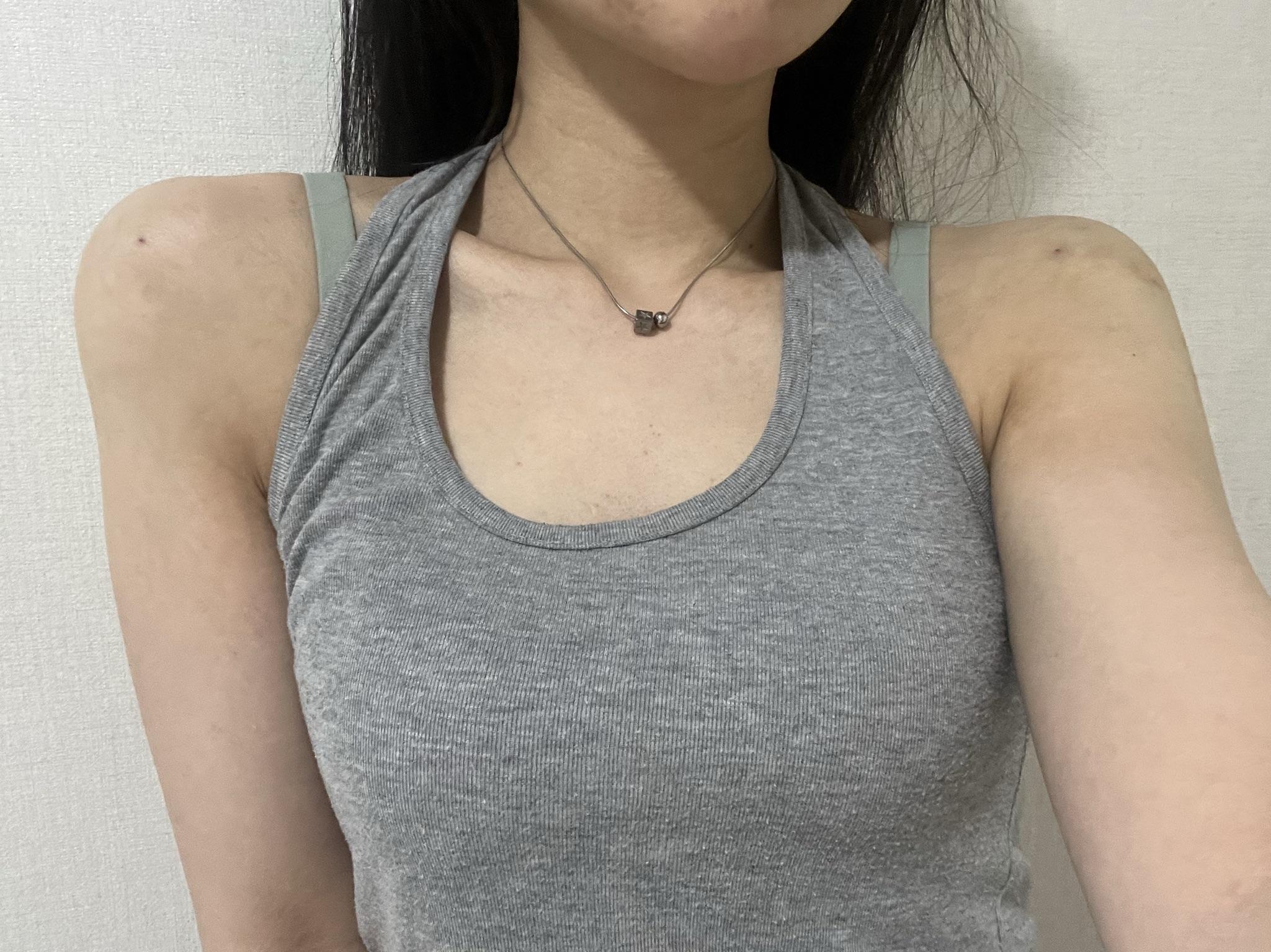 後