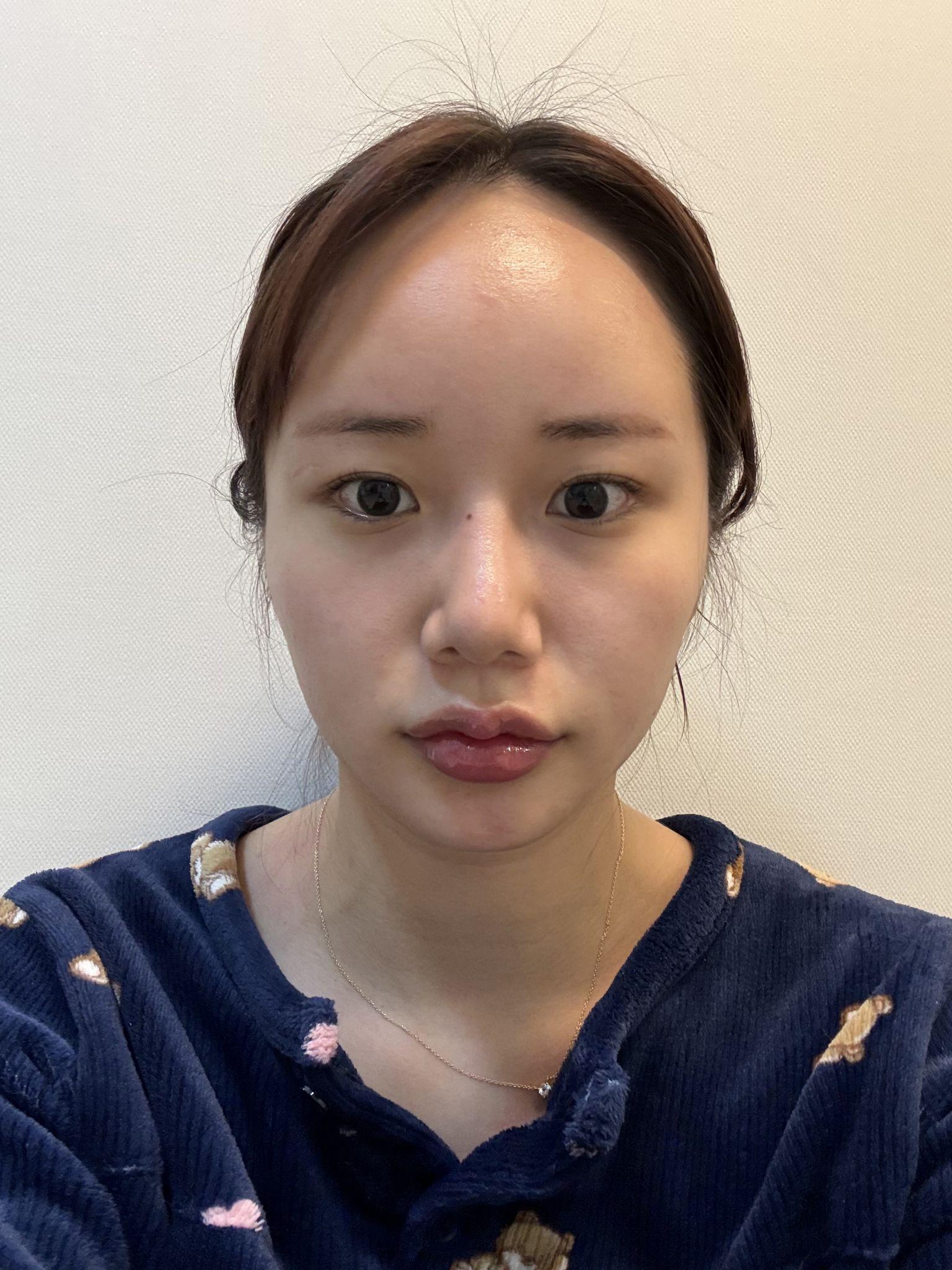 後