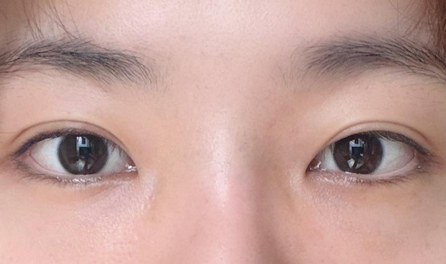 後