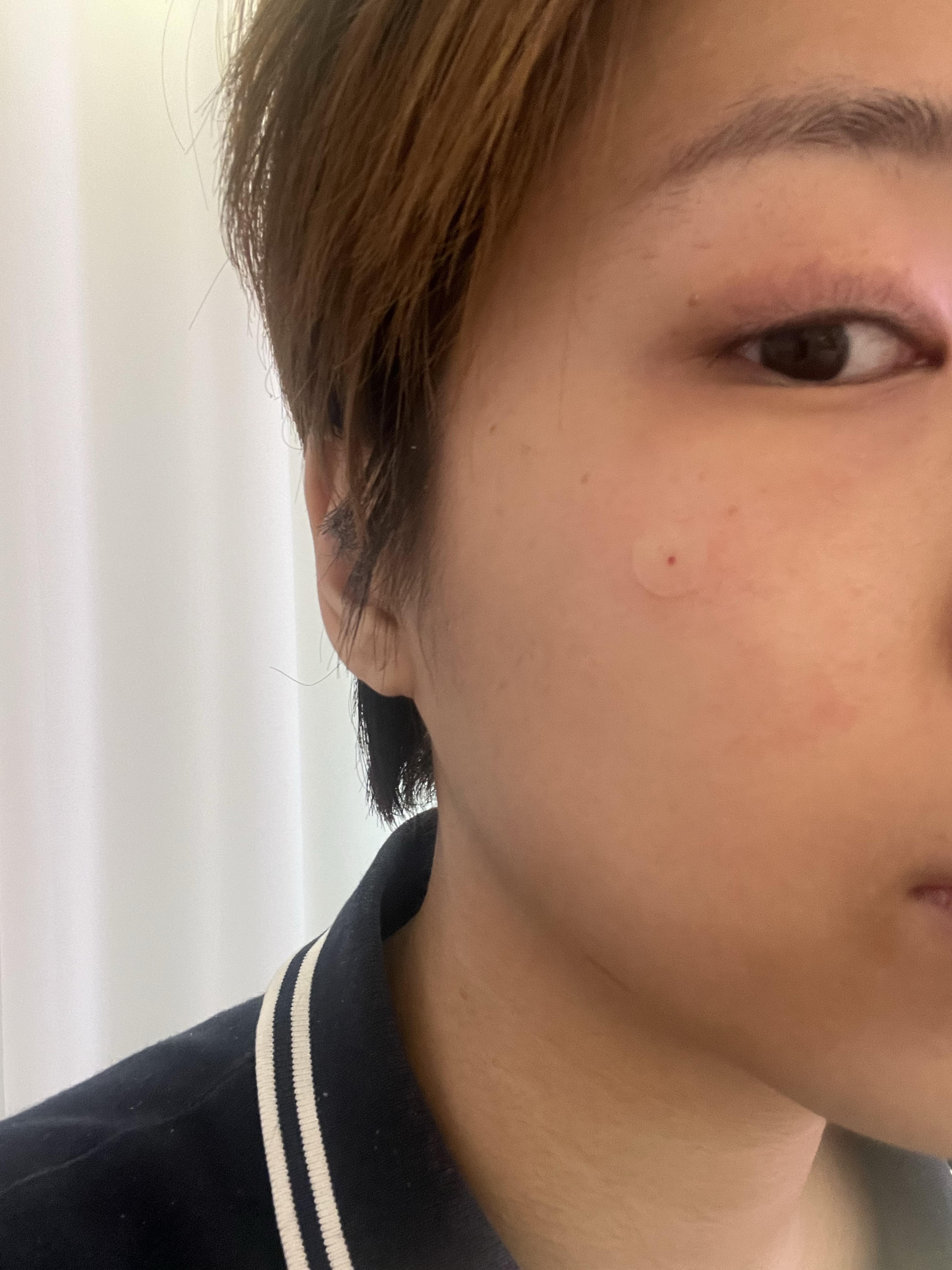 后