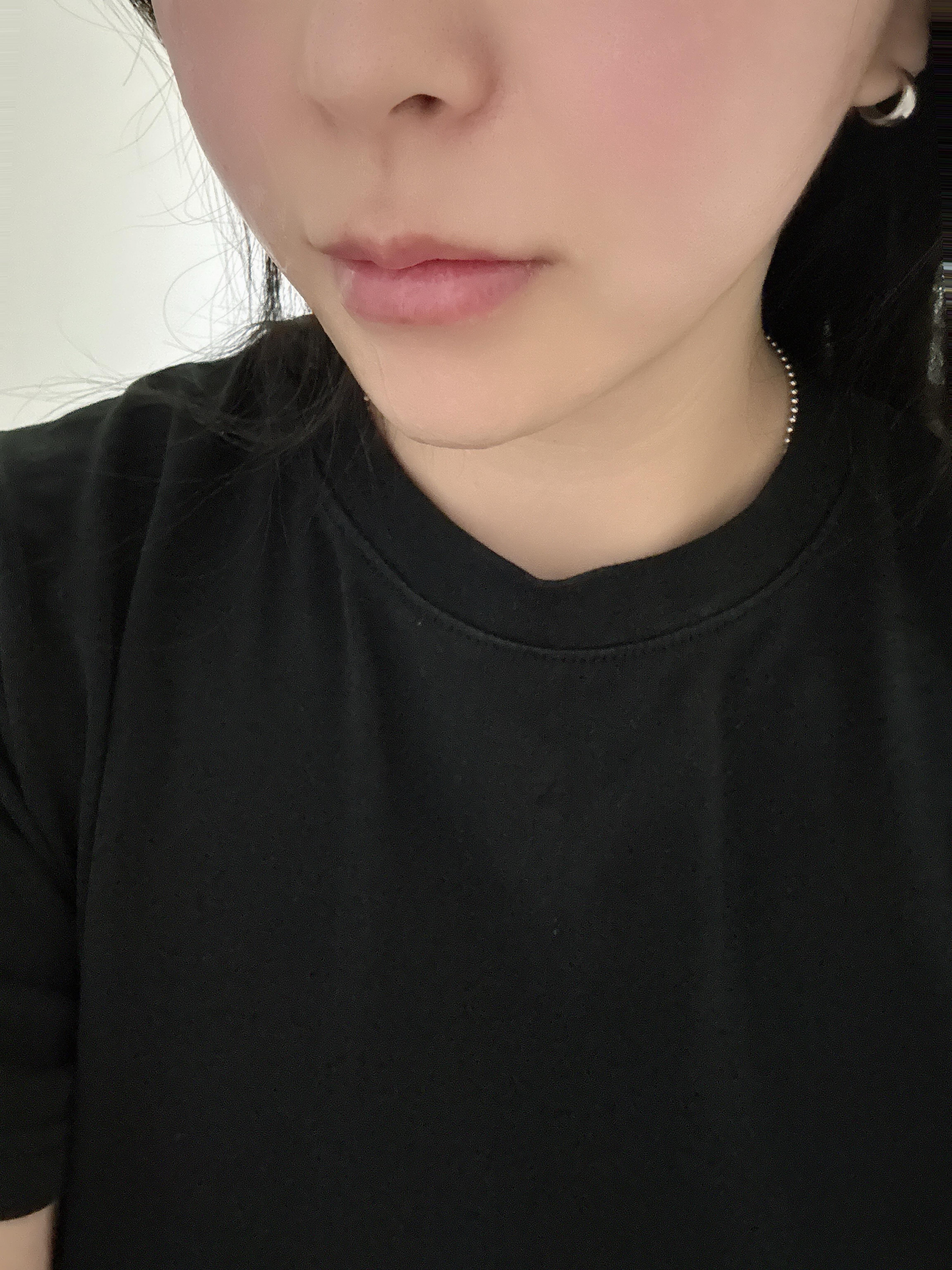 後