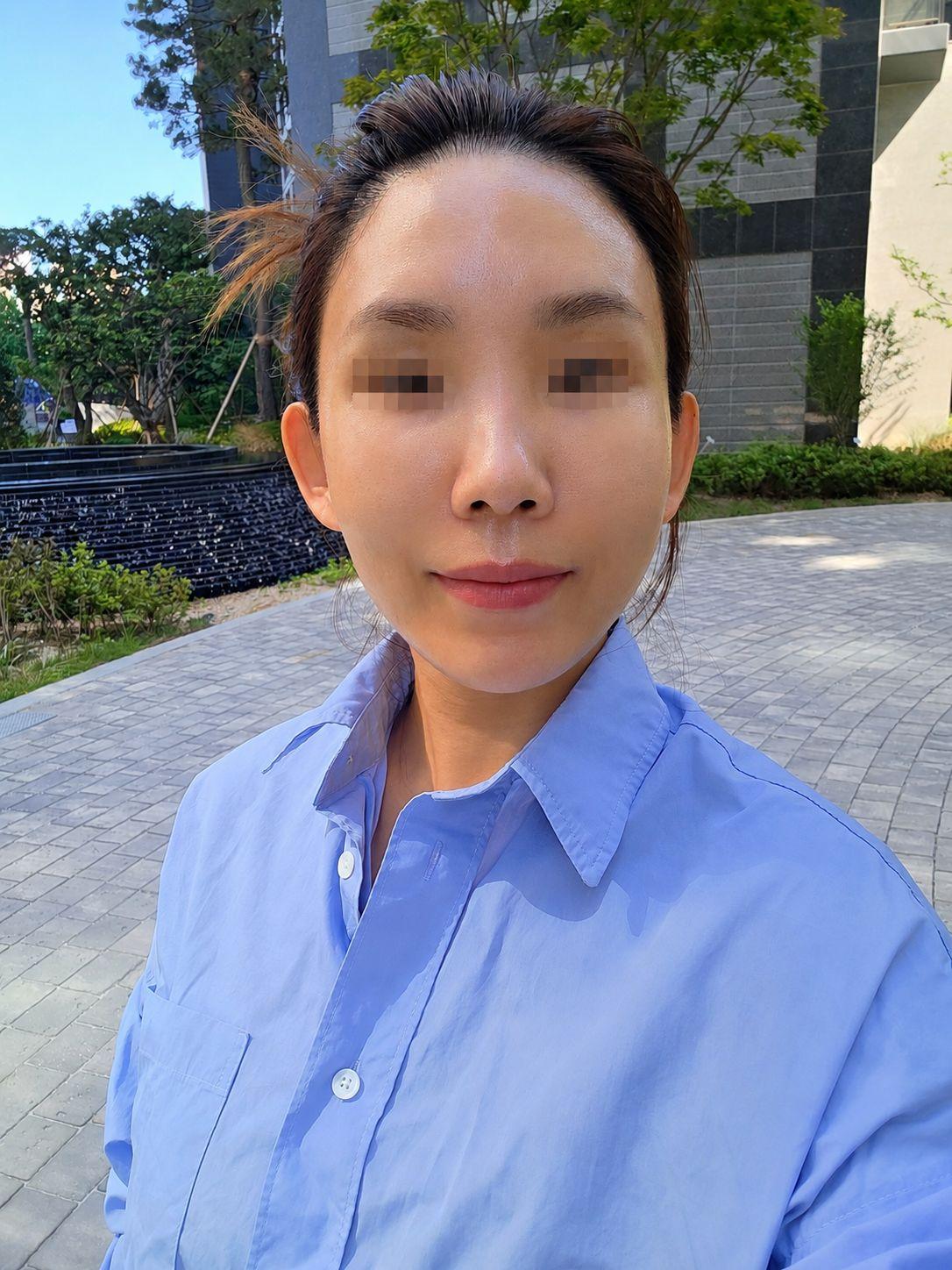 後