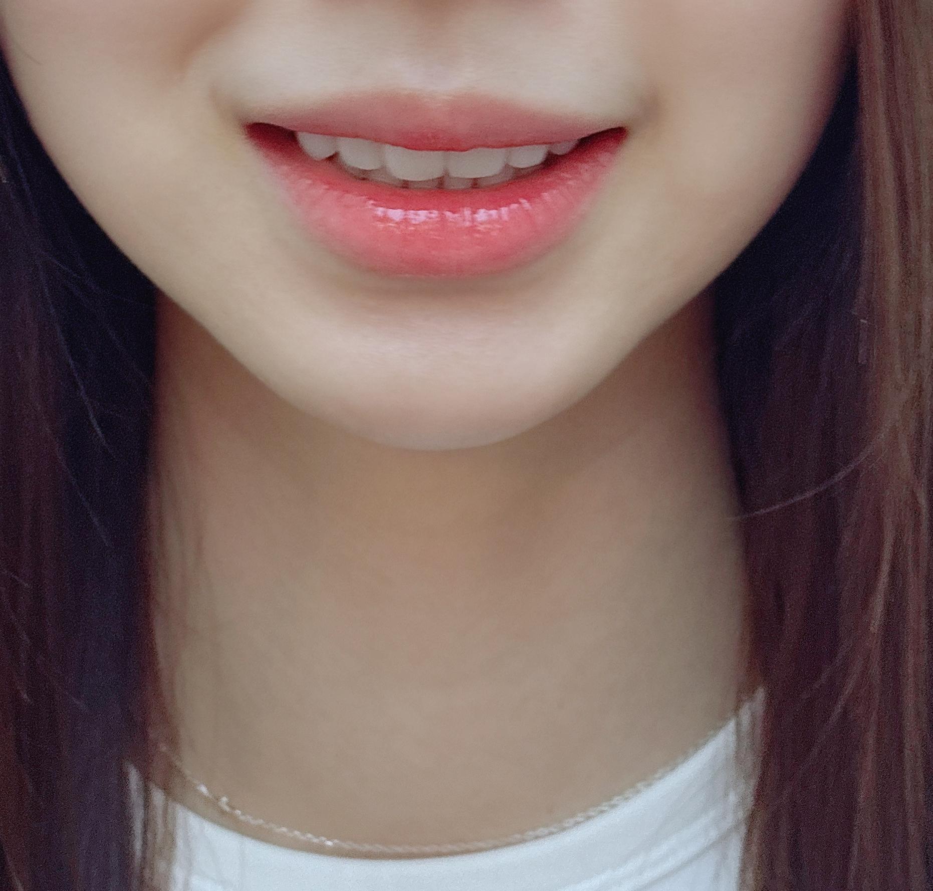 後