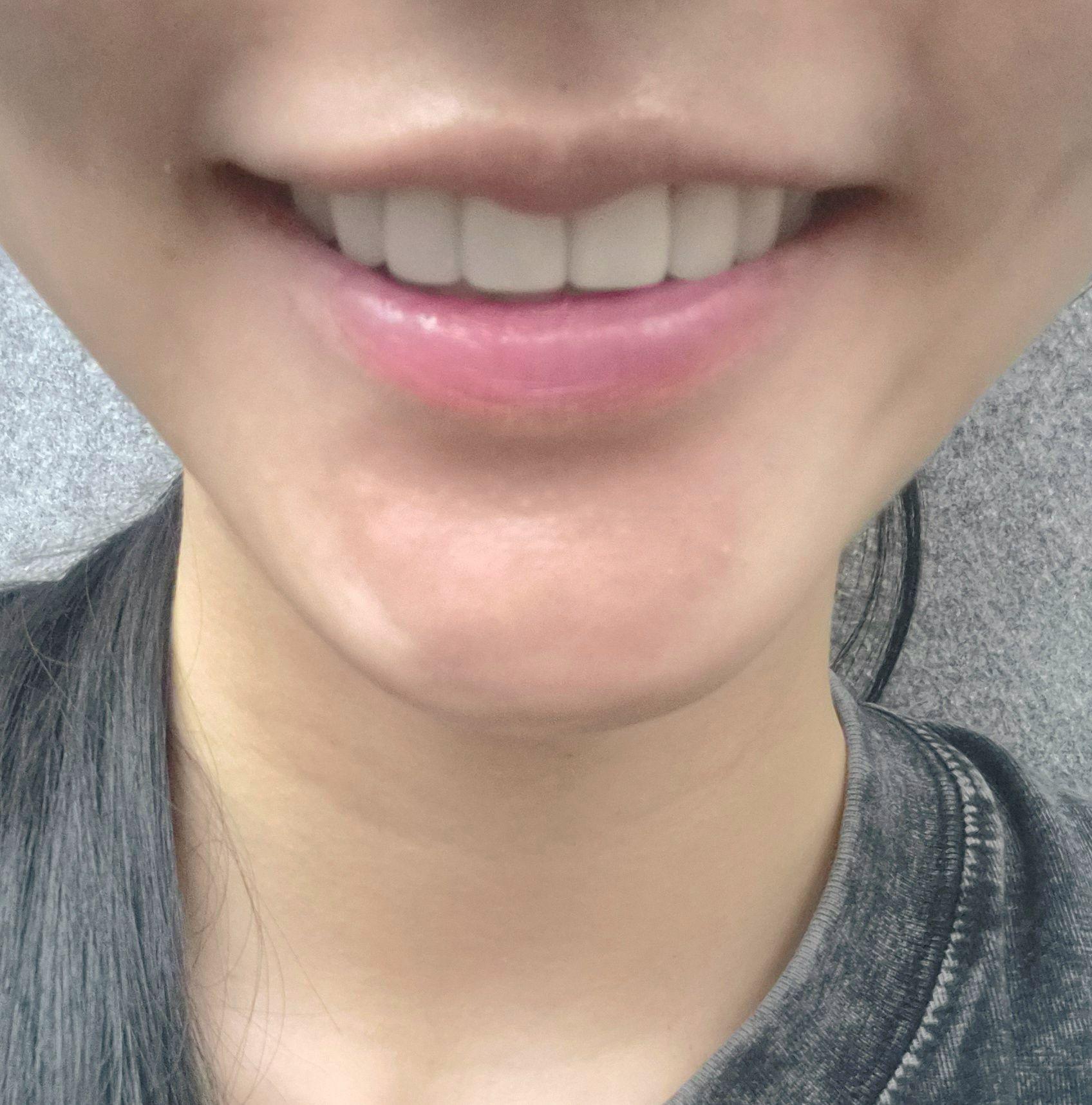 後