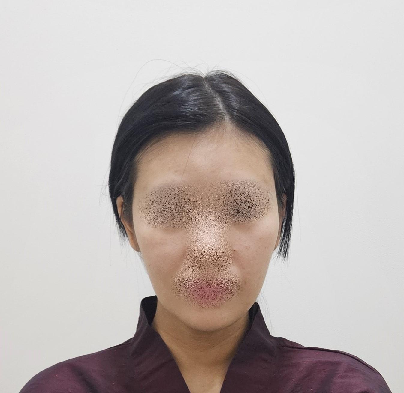 後