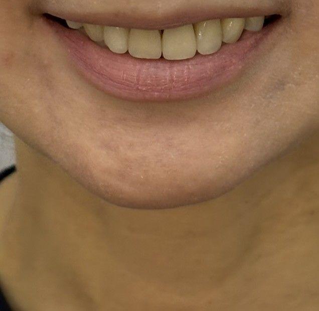 後
