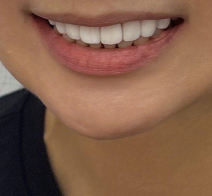 後