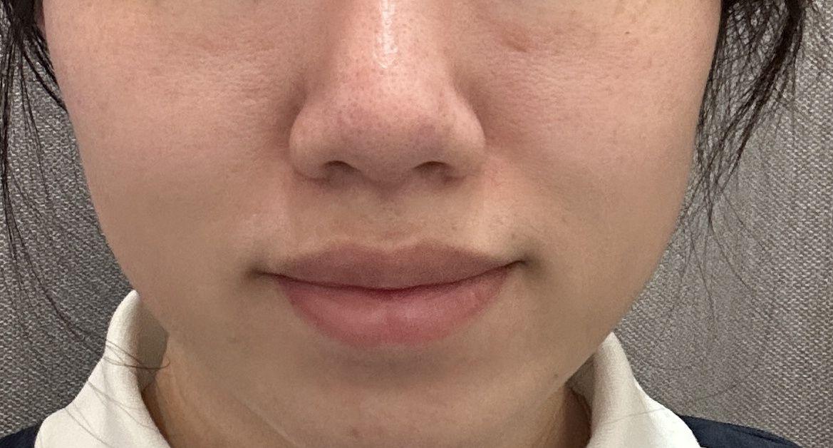 後