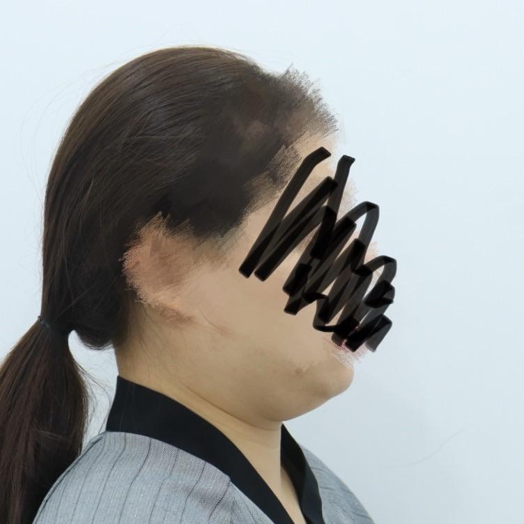 後