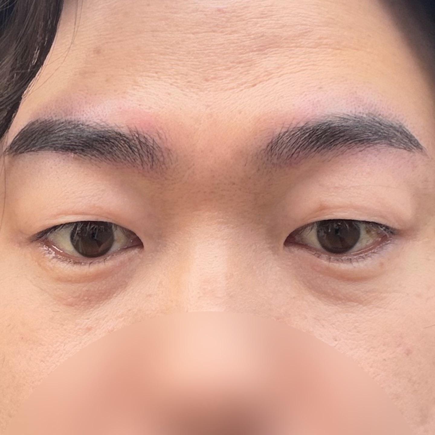 後