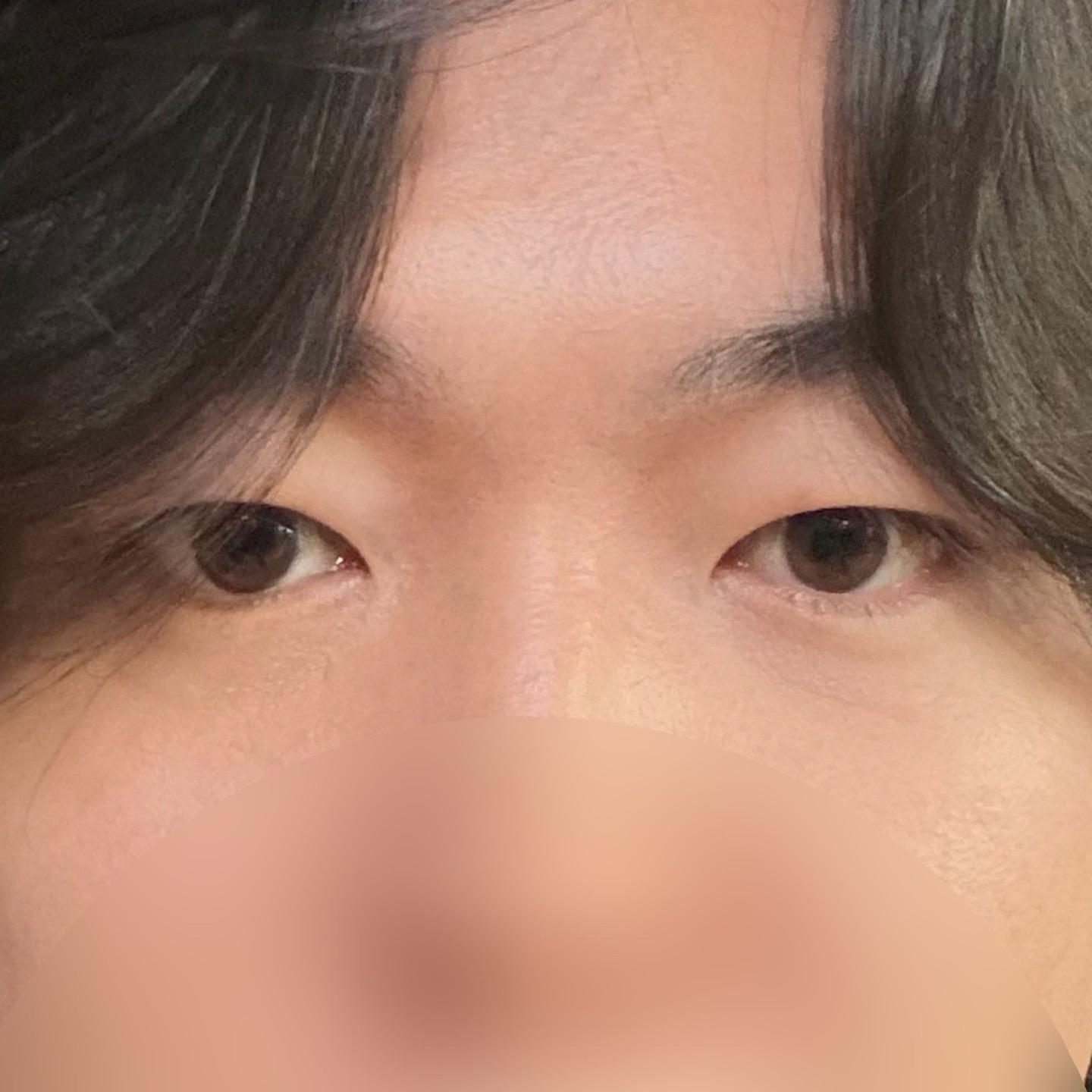 後