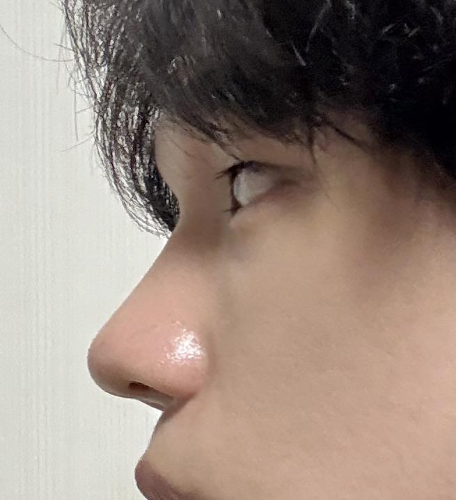 後