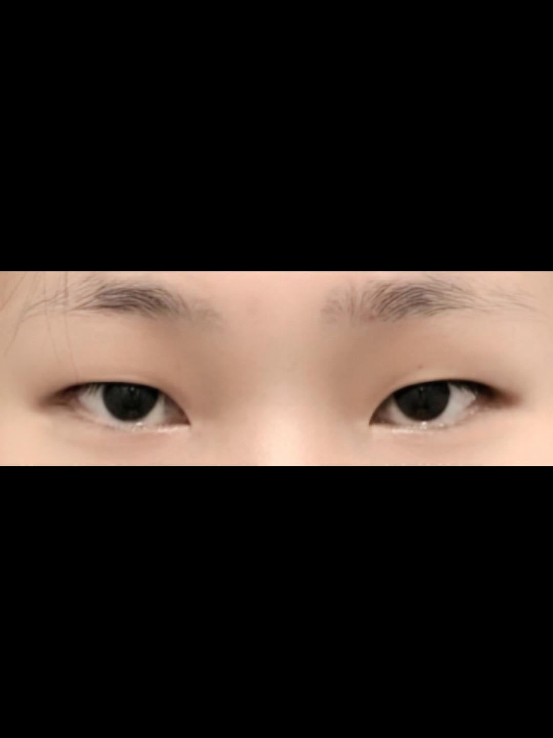 後