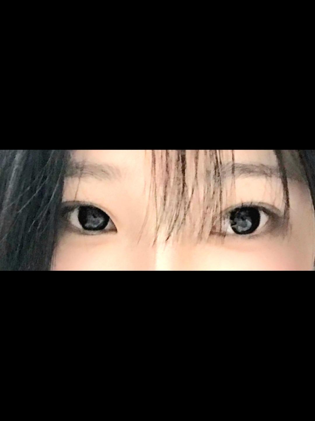 後