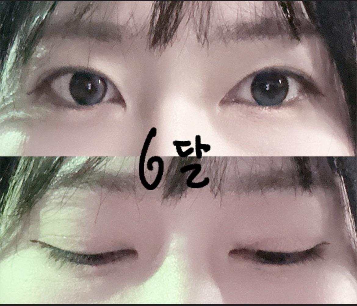 后