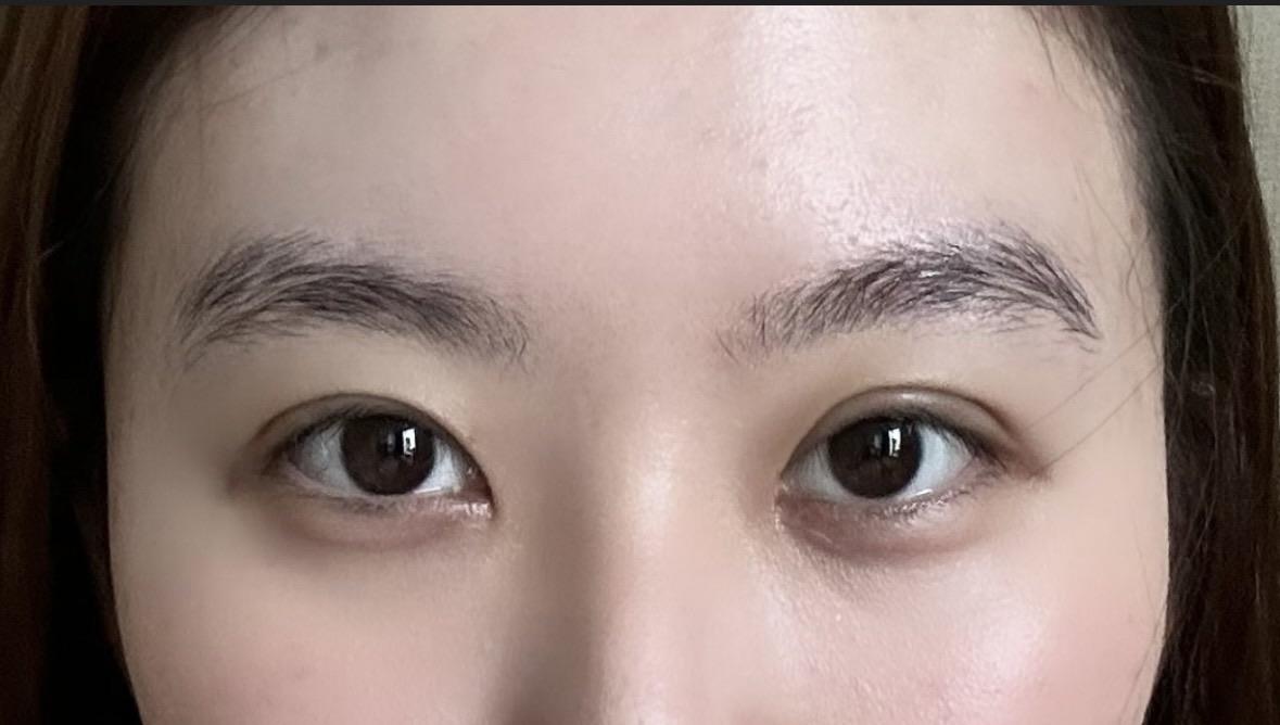 后
