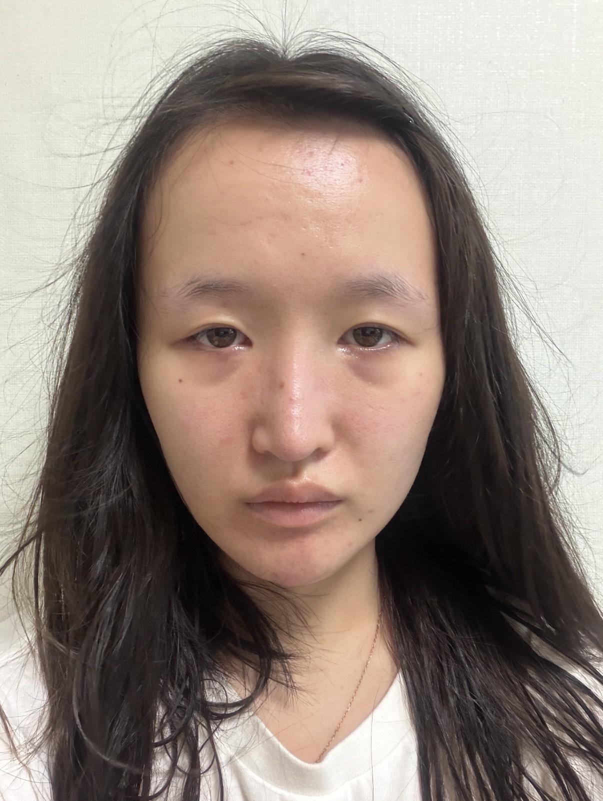 前