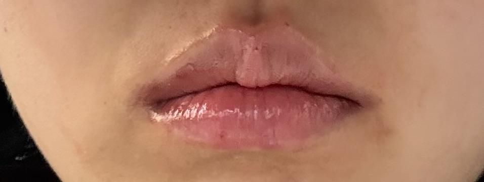 后