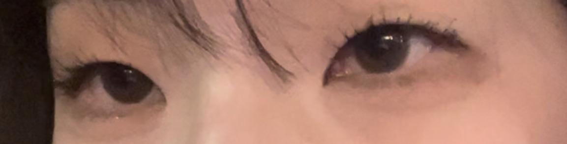 後