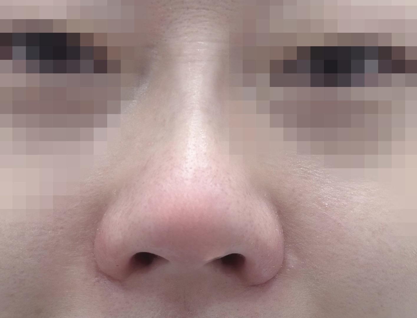 後