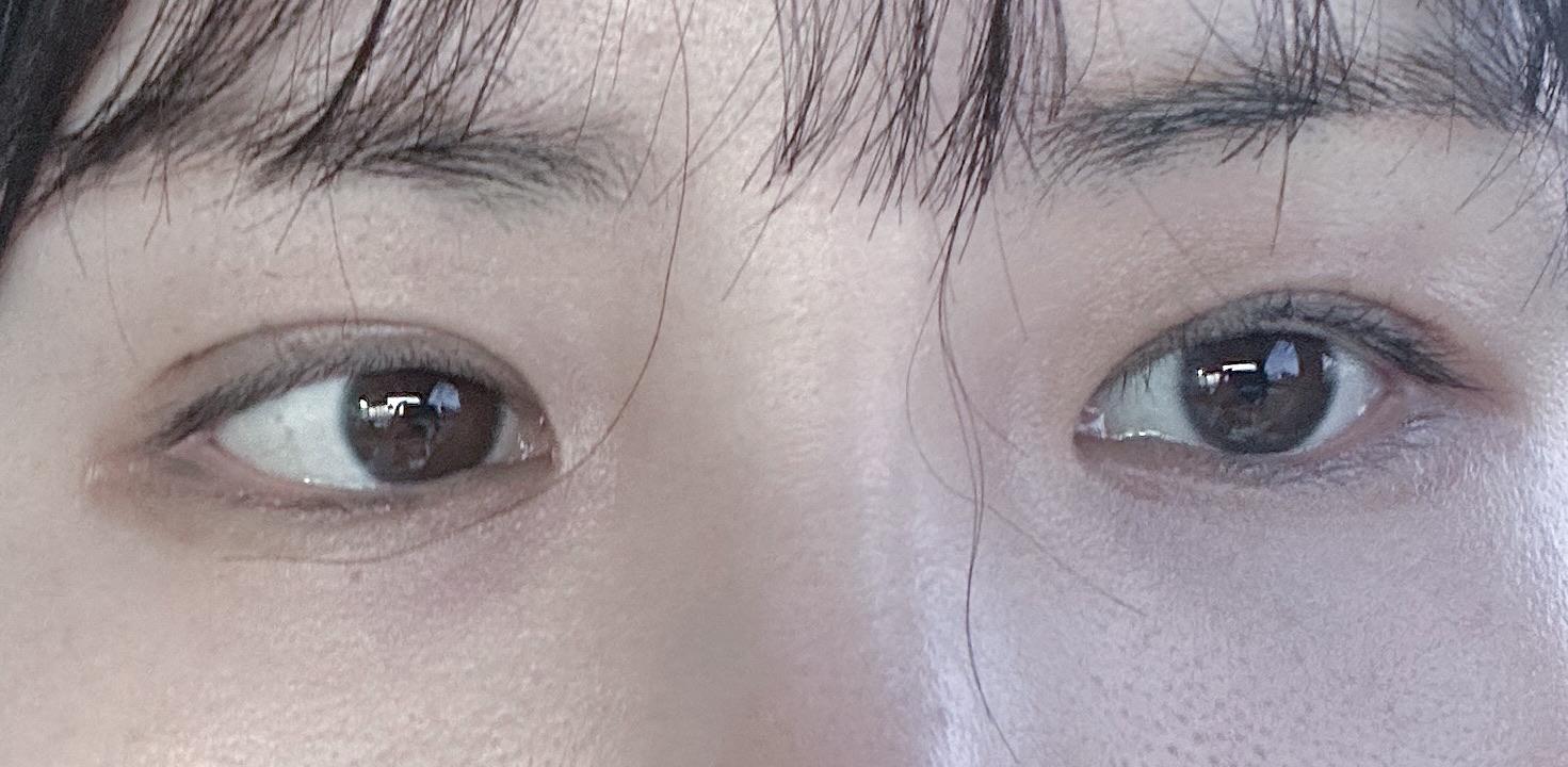 後