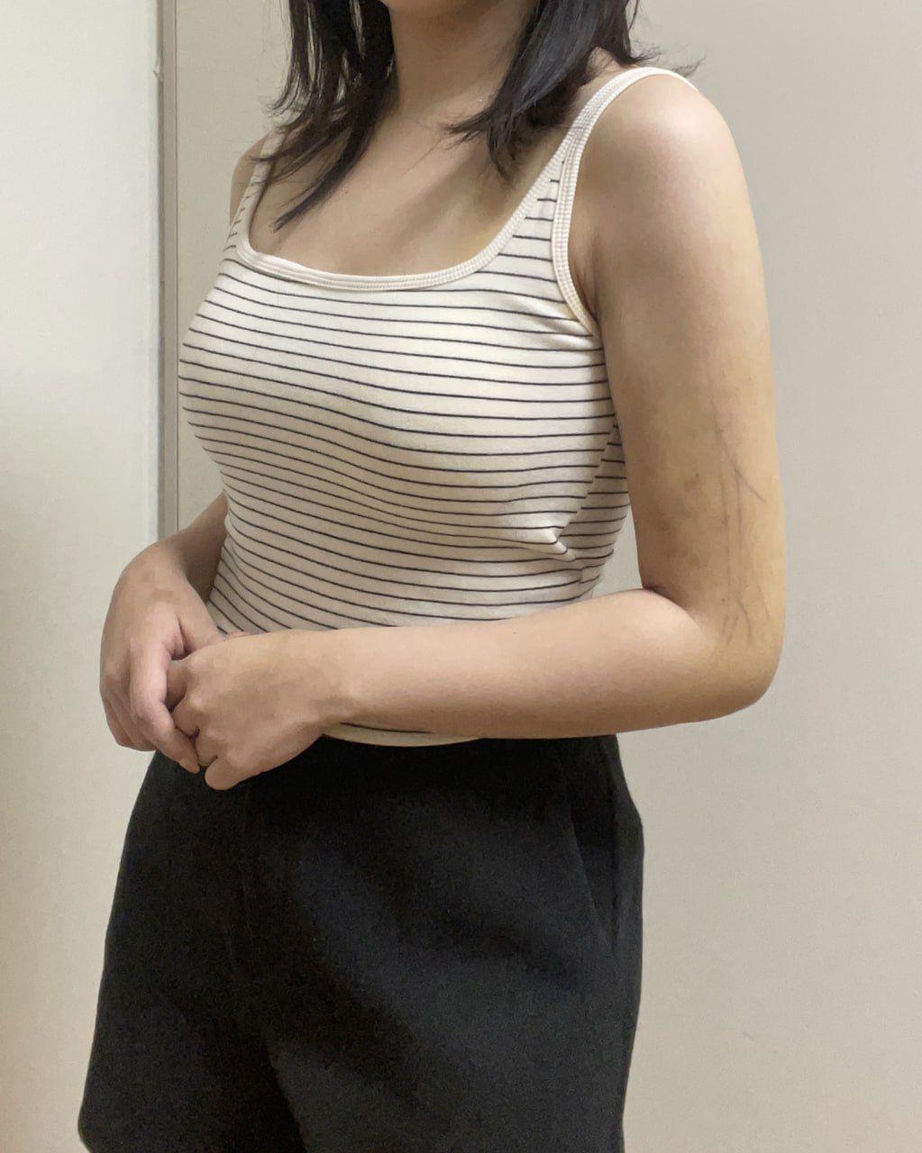 後