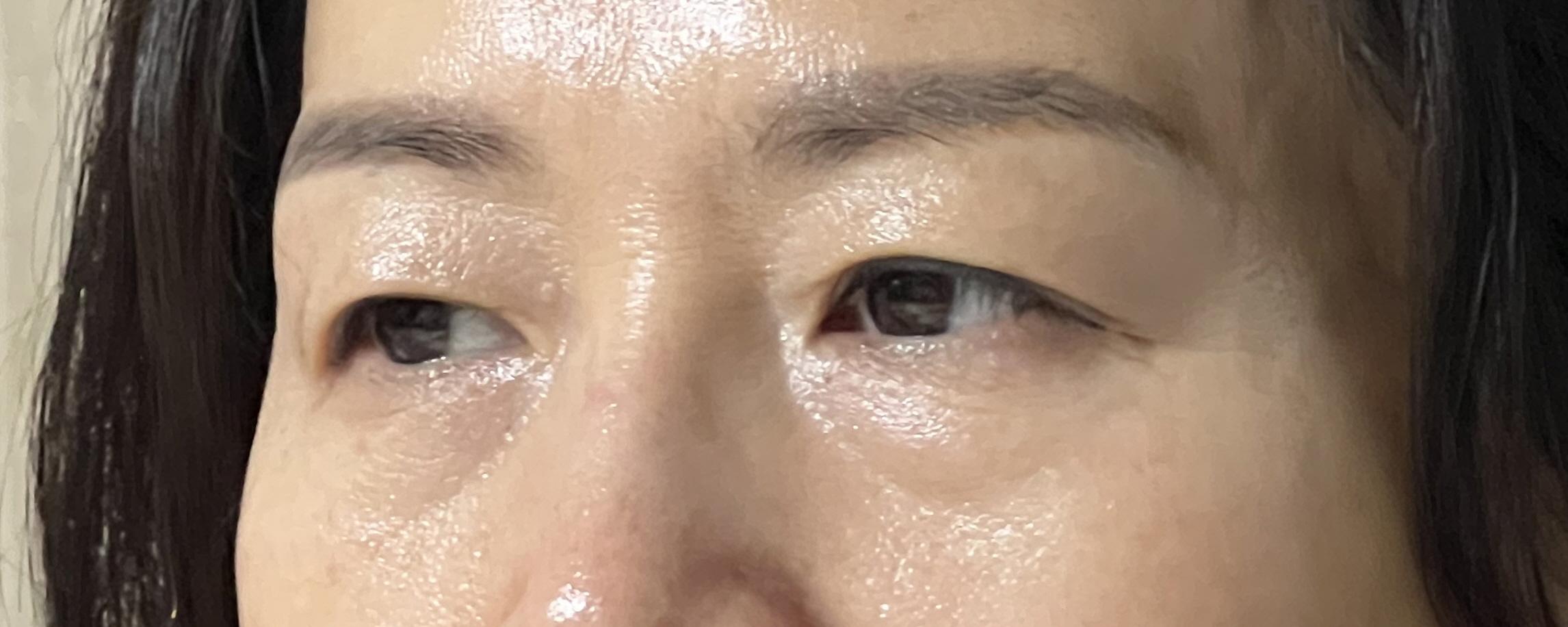 後