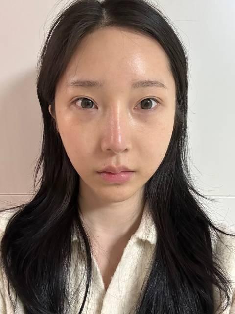 後