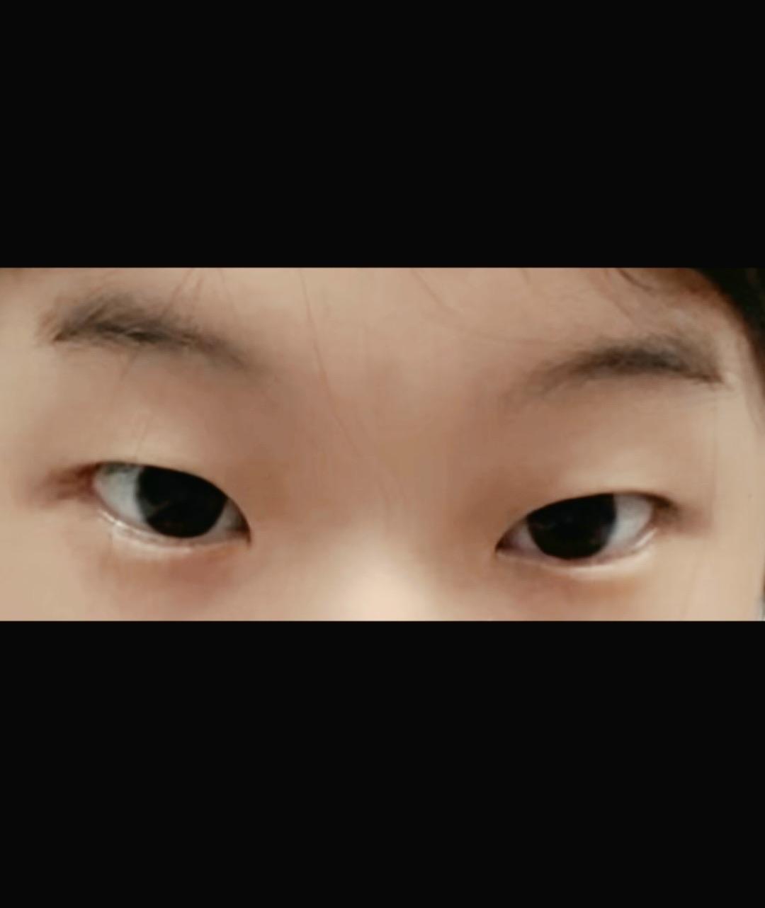 後