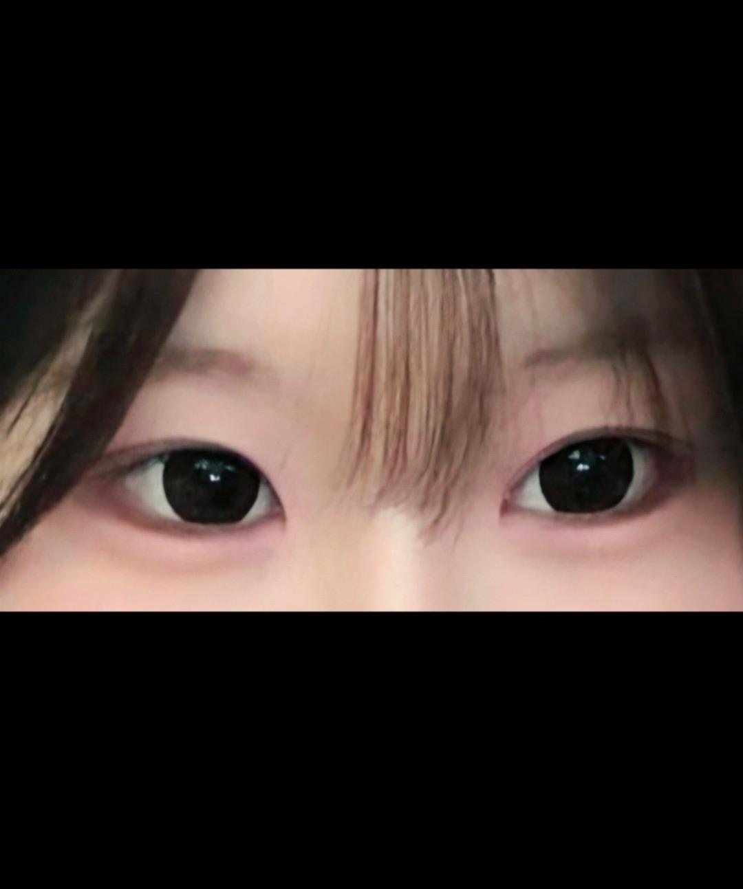 後