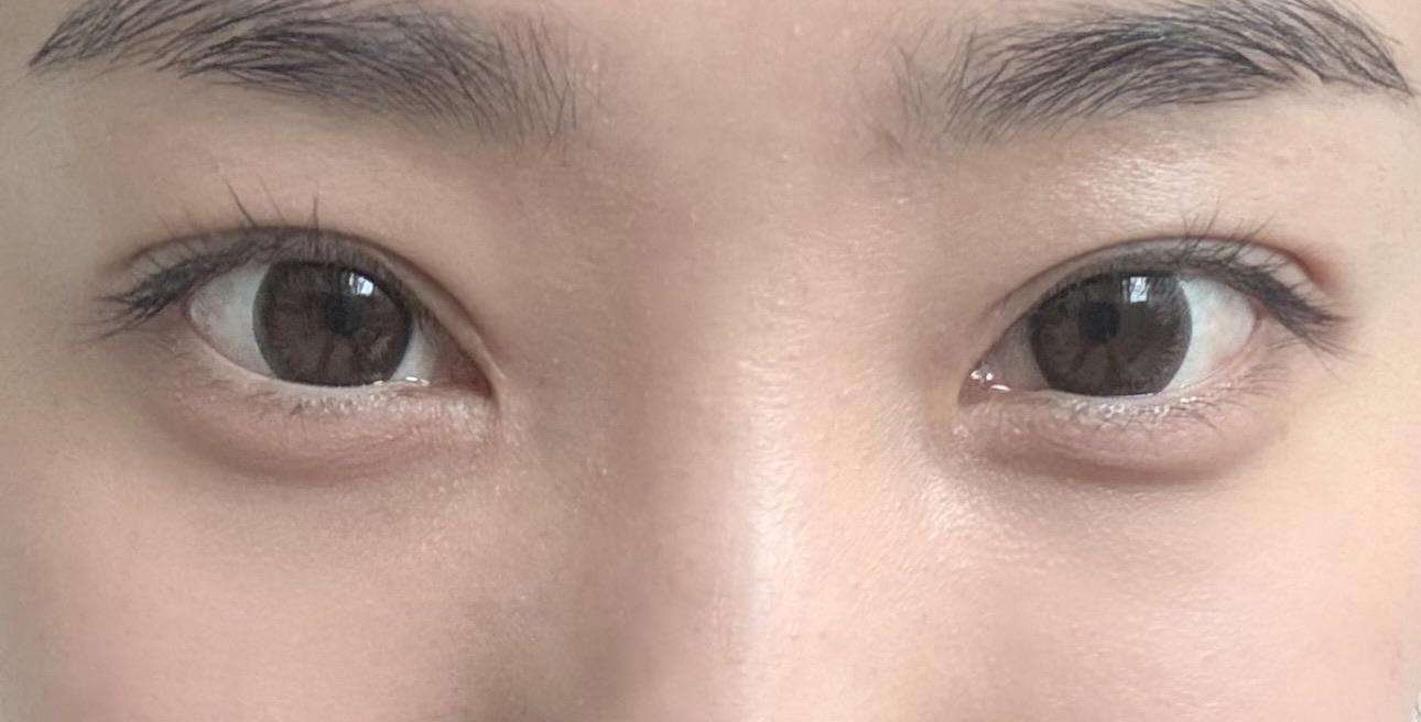 後