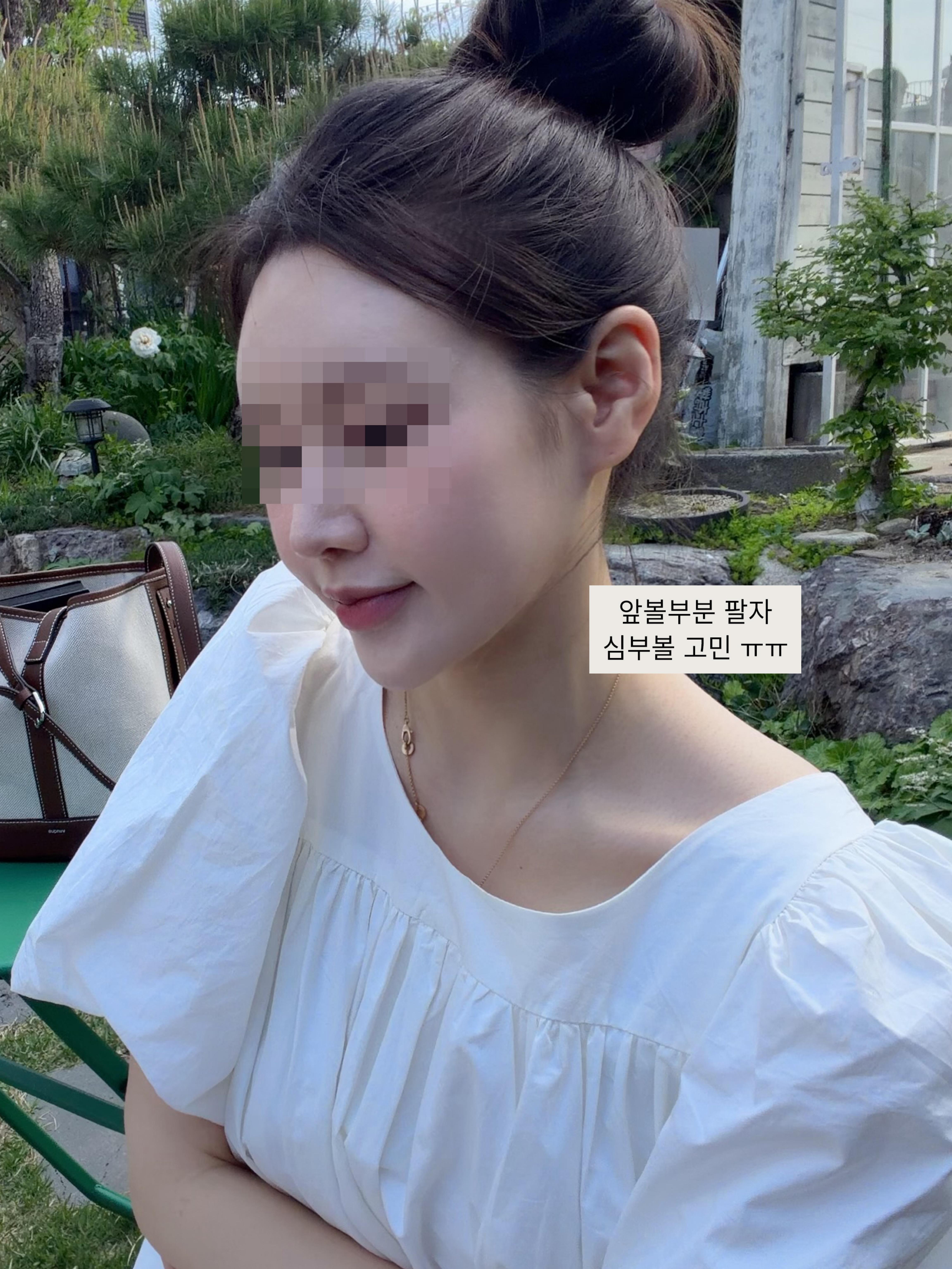 後