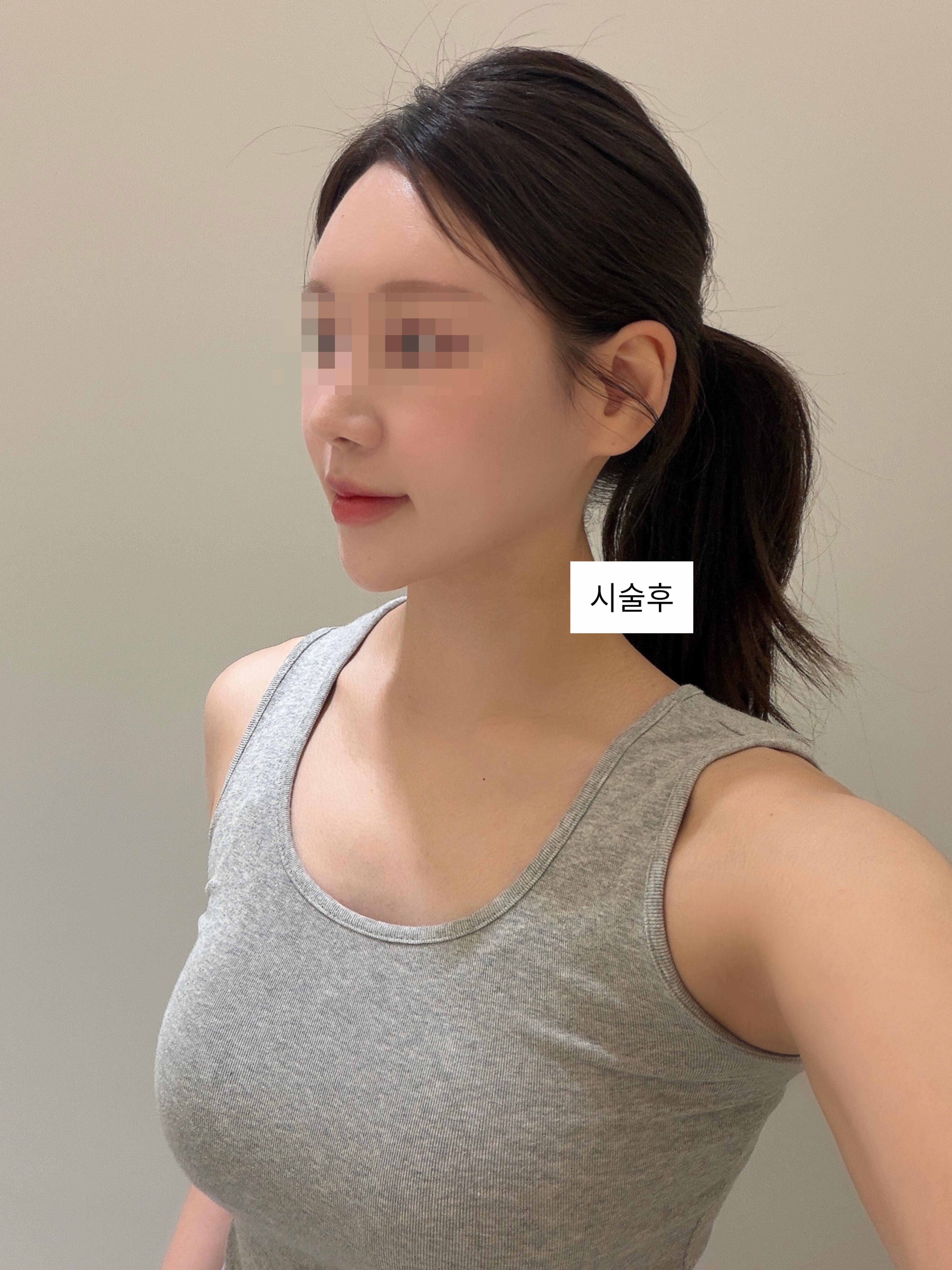 後