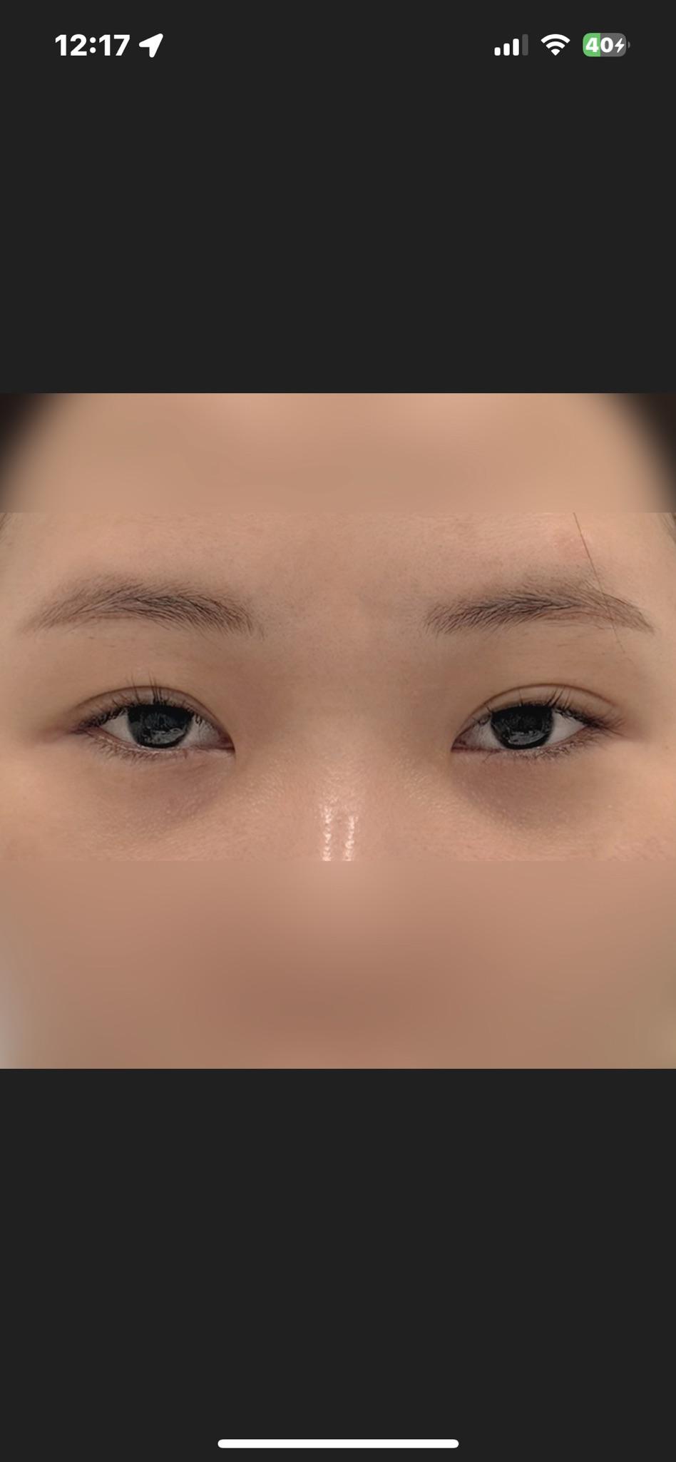 Before