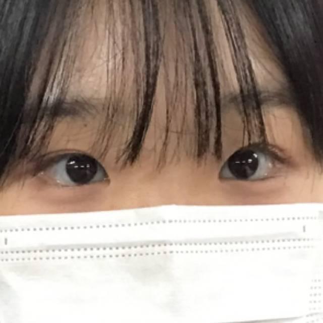 後