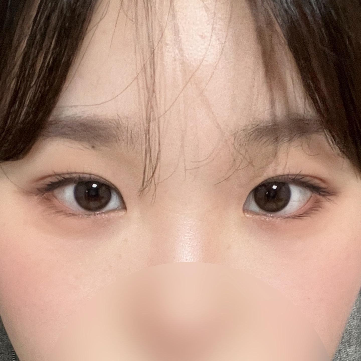後