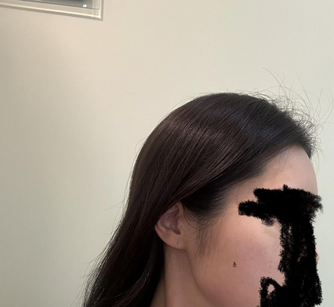 後