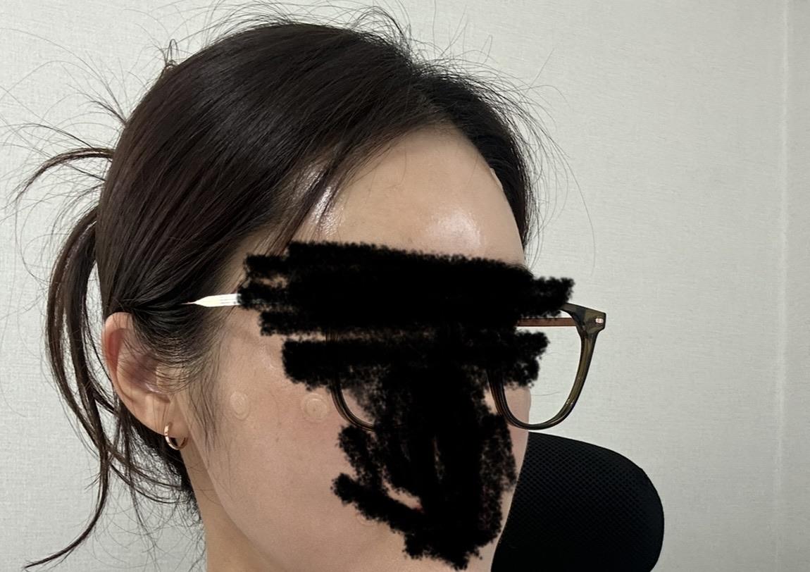 後
