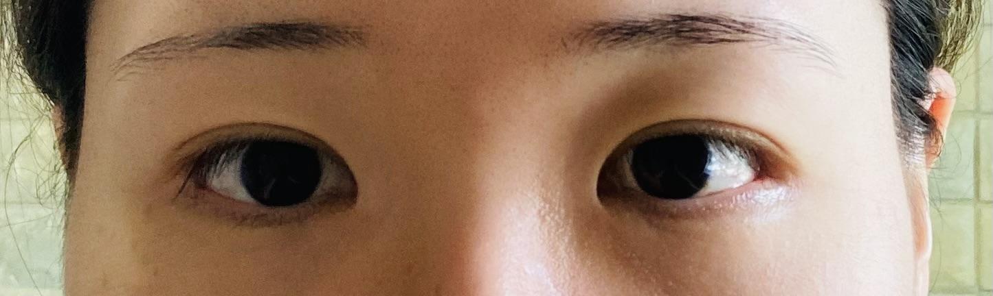 前
