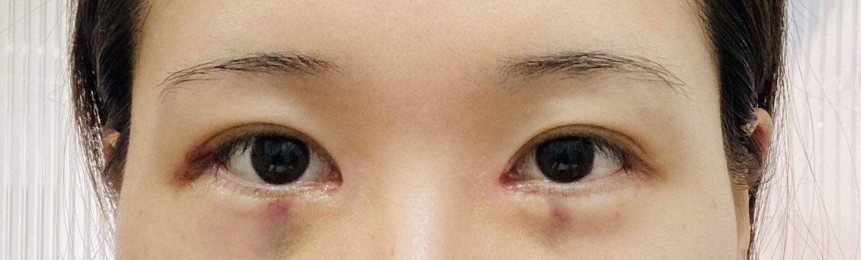 後